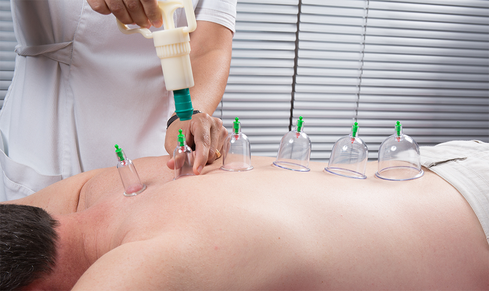Dry Cupping